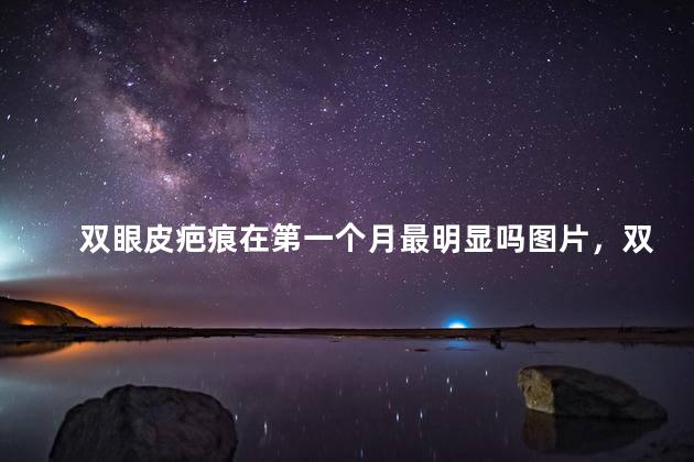 双眼皮疤痕在第一个月最明显吗图片，双眼皮疤痕在第一个月最明显吗大全