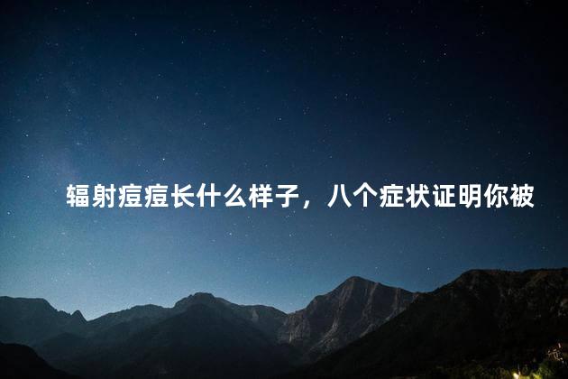 辐射痘痘长什么样子，八个症状证明你被辐射